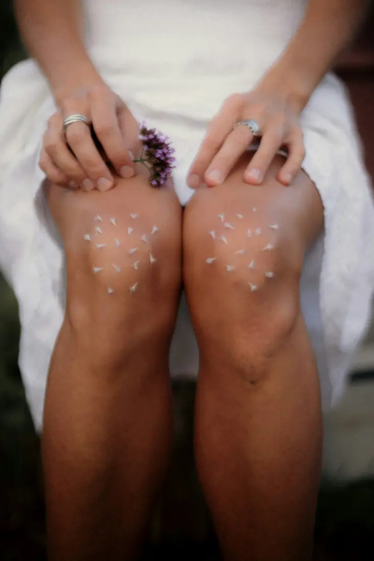 Dots of lotion on a woman's knees, a white towel beside